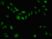 Immunofluorescent analysis of Hela cells using CSB-PA517674LA01HU at dilution of 1:100 and Alexa Fluor 488-congugated AffiniPure Goat Anti-Rabbit IgG(H+L)