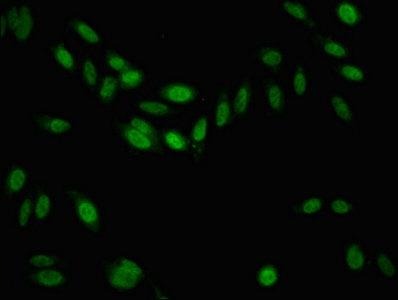 Immunofluorescent analysis of Hela cells using CSB-PA517674LA01HU at dilution of 1:100 and Alexa Fluor 488-congugated AffiniPure Goat Anti-Rabbit IgG(H+L)