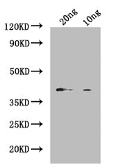Western Blot Positive WB detected in: recombinant protein All lanes: Vitellogenin Antibody at 1:1000 Secondary Goat polyclonal to rabbit IgG at 1/50000 dilution Predicted band size: 45 kDa Observed band size: 45 kDa