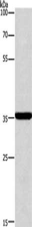 Gel: 8%SDS-PAGE, Lysate: 40 ug, Lane: Human brain malignant glioma tissue, Primary antibody: CSB-PA521713(CD207 Antibody) at dilution 1/250, Secondary antibody: Goat anti rabbit IgG at 1/8000 dilution, Exposure time: 20 seconds