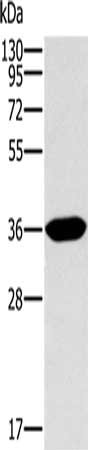 Gel: 10%SDS-PAGE, Lysate: 40 ug, Lane: Human fetal intestine tissue, Primary antibody: CSB-PA522045(ITLN1 Antibody) at dilution 1/400, Secondary antibody: Goat anti rabbit IgG at 1/8000 dilution, Exposure time: 2 minutes
