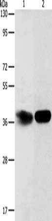 Gel: 12%SDS-PAGE, Lysate: 40 ug, Lane 1-2: Hela cells, mouse kidney tissue, Primary antibody: CSB-PA522867(ADPRHL2 Antibody) at dilution 1/500, Secondary antibody: Goat anti rabbit IgG at 1/8000 dilution, Exposure time: 2 minutes