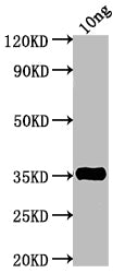 Western Blot Positive WB detected in Recombinant protein All lanes: TNF antibody at 1:2000 Secondary Goat polyclonal to rabbit IgG at 1/50000 dilution Predicted band size: 34.2 kDa Observed band size: 35 kDa