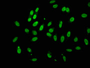 Immunofluorescence staining of Hela cells with CSB-PA523988LA01HU at 1:100, counter-stained with DAPI. The cells were fixed in 4% formaldehyde, permeabilized using 0.2% Triton X-100 and blocked in 10% normal Goat Serum. The cells were then incubat...