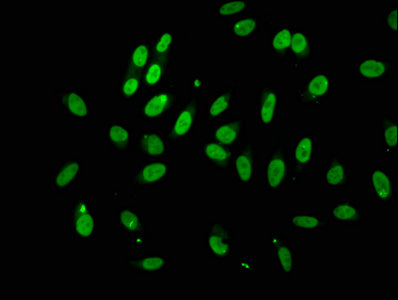 Immunofluorescence staining of Hela cells with CSB-PA523988LA01HU at 1:100, counter-stained with DAPI. The cells were fixed in 4% formaldehyde, permeabilized using 0.2% Triton X-100 and blocked in 10% normal Goat Serum. The cells were then incubat...