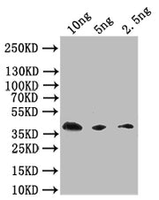 Western Blot Positive WB detected in: recombinant protein All lanes: Extracellular calcium-sensing receptor Antibody at 1:1000 Secondary Goat polyclonal to rabbit IgG at 1/50000 dilution Predicted band size: 38 kDa Observed band size: 38 kDa