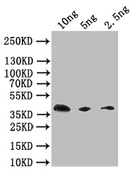 Western Blot Positive WB detected in: recombinant protein All lanes: Extracellular calcium-sensing receptor Antibody at 1:1000 Secondary Goat polyclonal to rabbit IgG at 1/50000 dilution Predicted band size: 38 kDa Observed band size: 38 kDa