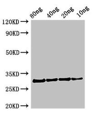 Western Blot Positive WB detected in Recombinant protein All lanes: Profilin antibody at 2.7µg/ml Secondary Goat polyclonal to rabbit IgG at 1/50000 dilution Predicted band size: 31 kDa Observed band size: 31 kDa