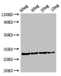 Western Blot Positive WB detected in Recombinant protein All lanes: Profilin antibody at 2.7µg/ml Secondary Goat polyclonal to rabbit IgG at 1/50000 dilution Predicted band size: 31 kDa Observed band size: 31 kDa