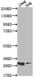Western Blot Positive WB detected in Recombinant protein All lanes: csgD antibody at 1:2000 Secondary Goat polyclonal to rabbit IgG at 1/50000 dilution Predicted band size: 28.9 kDa Observed band size: 29 kDa