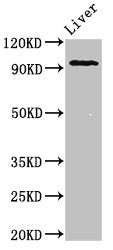 Western Blot Positive WB detected in: Mouse liver tissue All lanes: KDM1A antibody at 2µg/ml Secondary Goat polyclonal to rabbit IgG at 1/50000 dilution Predicted band size: 93, 96 kDa Observed band size: 93 kDa