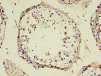 Immunohistochemistry of paraffin-embedded human testis tissue using CSB-PA525638LA01HU at dilution of 1:100
