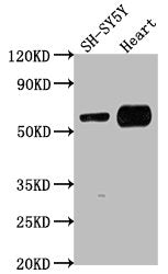 Western Blot Positive WB detected in: SH-SY5Y whole cell lysate, Mouse heart tissue All lanes: JRK antibody at 1:1000 Secondary Goat polyclonal to rabbit IgG at 1/50000 dilution Predicted band size: 62, 63 kDa Observed band size: 62 kDa