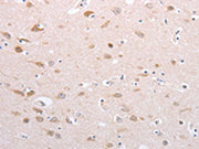 The image on the left is immunohistochemistry of paraffin-embedded Human brain tissue using CSB-PA526117(PFN4 Antibody) at dilution 1/20, on the right is treated with fusion protein. (Original magnification: ×200)