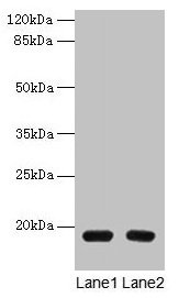 Western blot All lanes: PDE6D antibody at 1.5µg/ml Lane 1: A549 whole cell lysate Lane 2: MCF-7 whole cell lysate Secondary Goat polyclonal to rabbit IgG at 1/10000 dilution Predicted band size: 18 kDa Observed band size: 18 kDa