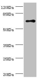 Western blot All lanes: RNGTT antibody at 1.42µg/ml + THP-1 whole cell lysate Secondary Goat polyclonal to rabbit IgG at 1/10000 dilution Predicted band size: 69, 67, 53, 62 kDa Observed band size: 69 kDa