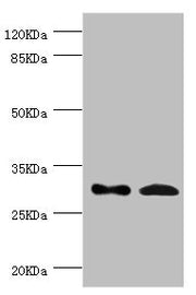 Western blot All lanes: ZWINT antibody at 8.93ug/ml Lane 1: Hela whole cell lysate Lane 2: Mouse liver tissue Secondary Goat polyclonal to rabbit IgG at 1/10000 dilution Predicted band size: 32, 26 kDa Observed band size: 32 kDa