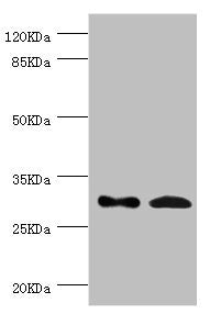 Western blot All lanes: ZWINT antibody at 8.93ug/ml Lane 1: Hela whole cell lysate Lane 2: Mouse liver tissue Secondary Goat polyclonal to rabbit IgG at 1/10000 dilution Predicted band size: 32, 26 kDa Observed band size: 32 kDa