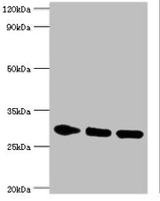 Western blot All lanes: PRKAB2 antibody at 5ug/ml Lane 1: Rat brain tissue Lane 2: Mouse heart tissue Lane 3: Mouse gonad tissue Secondary Goat polyclonal to rabbit IgG at 1/10000 dilution Predicted band size: 31, 22 kDa Observed band size: 31 kDa