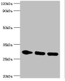 Western blot All lanes: PRKAB2 antibody at 5ug/ml Lane 1: Rat brain tissue Lane 2: Mouse heart tissue Lane 3: Mouse gonad tissue Secondary Goat polyclonal to rabbit IgG at 1/10000 dilution Predicted band size: 31, 22 kDa Observed band size: 31 kDa