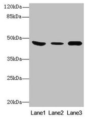 Western Blot All lanes: B4GALT5 antibody at 8µg/ml Lane 1: Mouse heart tissue Lane 2: Mouse liver tissue Lane 3: Mouse brain tissue Secondary Goat polyclonal to rabbit IgG at 1/10000 dilution Predicted band size: 46 kDa Observed band size: 46 kDa