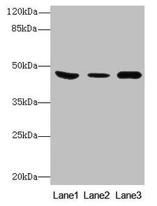 Western Blot All lanes: B4GALT5 antibody at 8µg/ml Lane 1: Mouse heart tissue Lane 2: Mouse liver tissue Lane 3: Mouse brain tissue Secondary Goat polyclonal to rabbit IgG at 1/10000 dilution Predicted band size: 46 kDa Observed band size: 46 kDa