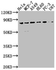 Western Blot Positive WB detected in: Hela whole cell lysate, MCF-7 whole cell lysate, A549 whole cell lysate, HL60 whole cell lysate, PC-3 whole cell lysate, U87 whole cell lysate All lanes: EXOC3 antibody at 1:2000 Secondary Goat polyclonal to r...