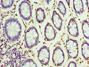 Immunohistochemistry of paraffin-embedded human colon tissue using CSB-PA528513DSR2HU at dilution of 1:100