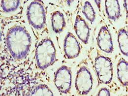 Immunohistochemistry of paraffin-embedded human colon tissue using CSB-PA528513DSR2HU at dilution of 1:100