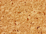 Immunohistochemistry of paraffin-embedded human brain tissue using CSB-PA528516LA01HU at dilution of 1:100