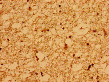 Immunohistochemistry of paraffin-embedded human brain tissue using CSB-PA528516LA01HU at dilution of 1:100