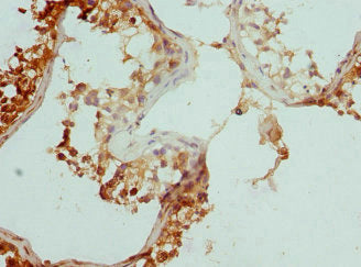 Immunohistochemistry of paraffin-embedded human testis tissue using CSB-PA528588ESR1HU at dilution of 1:100