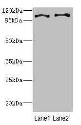 Western blot All lanes: CCP110 antibody at 4.6ug/ml Lane 1: Hela whole cell lysate Lane 2: 293T whole cell lysate Secondary Goat polyclonal to rabbit IgG at 1/10000 dilution Predicted band size: 114, 112 kDa Observed band size: 114 kDa