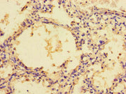 Immunohistochemistry of paraffin-embedded human lung tissue using CSB-PA528909LA01HU at dilution of 1:100