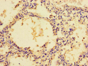 Immunohistochemistry of paraffin-embedded human lung tissue using CSB-PA528909LA01HU at dilution of 1:100