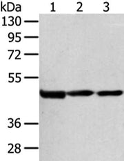 Gel: 8%SDS-PAGE, Lysate: 80 ug, Lane 1-3: Hela cell and human bladder carcinoma tissue, human normal liver tissue, Primary antibody: CSB-PA529469(AGPAT9 Antibody) at dilution 1/200 dilution, Secondary antibody: Goat anti rabbit IgG at 1/8000 dilut...