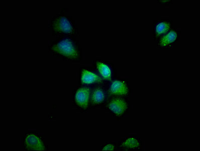 Immunofluorescence staining of Hela cells with CSB-PA529743LA01HU at 1:66, counter-stained with DAPI. The cells were fixed in 4% formaldehyde, permeabilized using 0.2% Triton X-100 and blocked in 10% normal Goat Serum. The cells were then incubate...