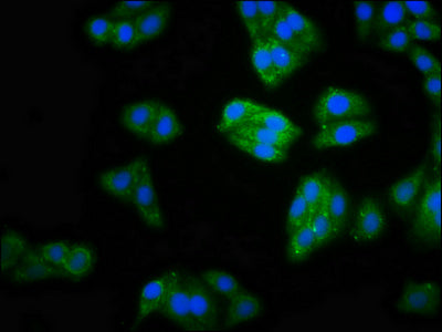 Immunofluorescence staining of HepG2 cells with CSB-PA529746LA01HU at 1:100, counter-stained with DAPI. The cells were fixed in 4% formaldehyde, permeabilized using 0.2% Triton X-100 and blocked in 10% normal Goat Serum. The cells were then incuba...
