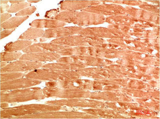Immunohistochemical analysis of paraffin-embedded Human Skeletal Muscle Tissue using ATG4b Rabbit pAb diluted at 1:200