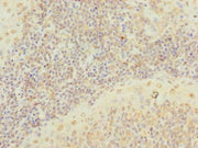Immunohistochemistry of paraffin-embedded human tonsil tissue using CSB-PA530448LA01HU at dilution of 1:100