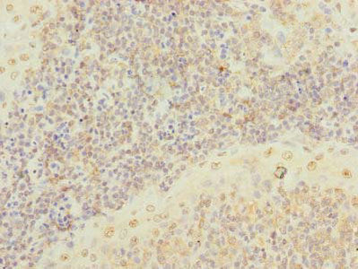 Immunohistochemistry of paraffin-embedded human tonsil tissue using CSB-PA530448LA01HU at dilution of 1:100