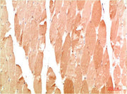 Immunohistochemical analysis of paraffin-embedded Human Skeletal Muslce Tissue using WIPI2 Rabbit pAb diluted at 1:200