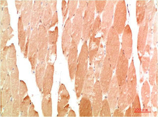 Immunohistochemical analysis of paraffin-embedded Human Skeletal Muslce Tissue using WIPI2 Rabbit pAb diluted at 1:200