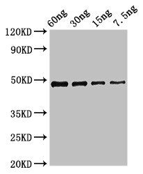 Western Blot Positive WB detected in Recombinant protein All lanes: cobB antibody at 2.7µg/ml Secondary Goat polyclonal to rabbit IgG at 1/50000 dilution Predicted band size: 49 kDa Observed band size: 49 kDa