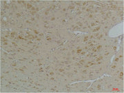 Immunohistochemical analysis of paraffin-embedded Rat BrainTissue using KChIP3 Rabbit pAb diluted at 1:200.