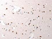 The image on the left is immunohistochemistry of paraffin-embedded Human brain tissue using CSB-PA537097(JUND Antibody) at dilution 1/40, on the right is treated with synthetic peptide. (Original magnification: ×200)