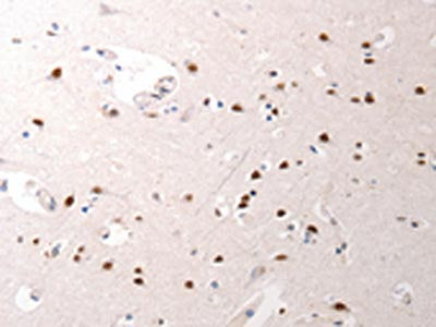 The image on the left is immunohistochemistry of paraffin-embedded Human brain tissue using CSB-PA537097(JUND Antibody) at dilution 1/40, on the right is treated with synthetic peptide. (Original magnification: ×200)