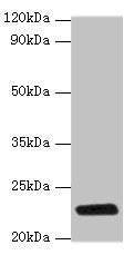 Western blot All lanes: rpiA antibody at 2µg/ml + DH5a whole cell lysate Secondary Goat polyclonal to rabbit IgG at 1/10000 dilution Predicted band size: 23 kDa Observed band size: 23 kDa