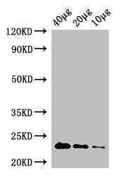 Western Blot Positive WB detected in: Rosseta bacteria lysate at 40µg, 20µg, 10µg All lanes: rpiA antibody at 1µg/ml Secondary Goat polyclonal to rabbit IgG at 1/50000 dilution Predicted band size: 23 kDa Observed band size: 23 kDa