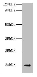 Western blot All lanes: luxS antibody at 2µg/ml + DH5a whole cell lysate Secondary Goat polyclonal to rabbit IgG at 1/10000 dilution Predicted band size: 20 kDa Observed band size: 20 kDa